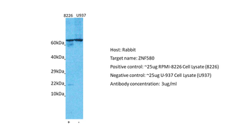 ZNF580 Rabbit Polyclonal Antibody