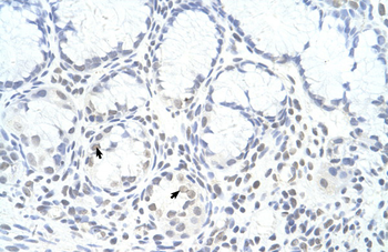 ZNF580 Rabbit Polyclonal Antibody