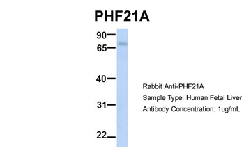 PHF21A Rabbit Polyclonal Antibody