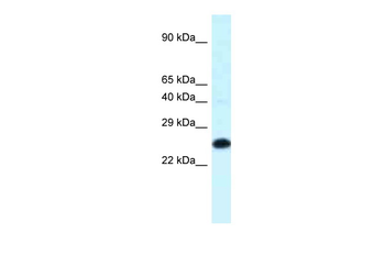 Hoxb9 Rabbit Polyclonal Antibody