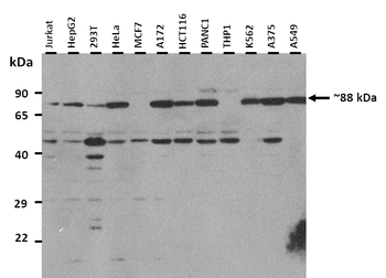 NOTCH1 Rabbit Polyclonal Antibody