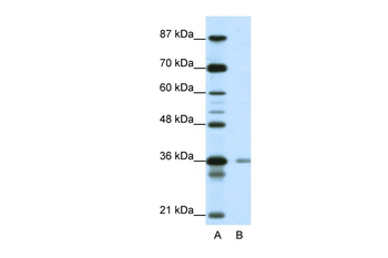 HIF1AN Rabbit Polyclonal Antibody
