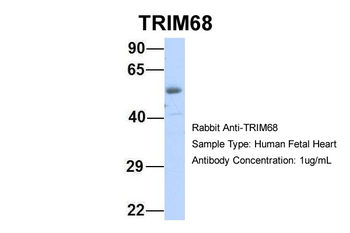 TRIM68 Rabbit Polyclonal Antibody