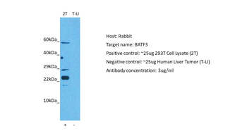 BATF3 Rabbit Polyclonal Antibody