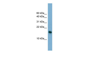 BATF3 Rabbit Polyclonal Antibody