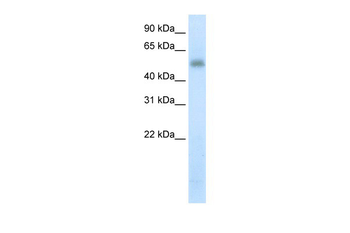 METTL3 Rabbit Polyclonal Antibody