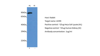 AHRR Rabbit Polyclonal Antibody