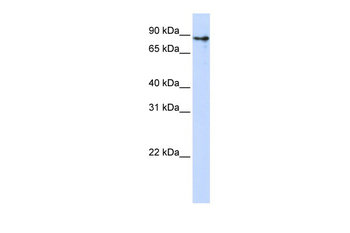 KLHL1 Rabbit Polyclonal Antibody