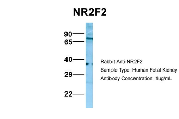 NR2F2 Rabbit Polyclonal Antibody