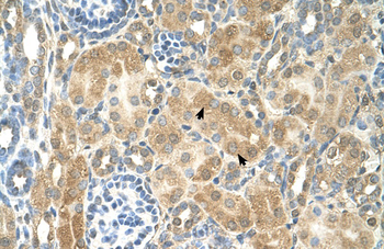 NR2F2 Rabbit Polyclonal Antibody
