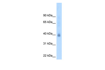NR2F2 Rabbit Polyclonal Antibody