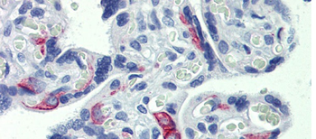 ZNF71 Rabbit Polyclonal Antibody