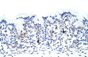 ZNF70 Rabbit Polyclonal Antibody