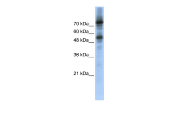 FOXM1 Rabbit Polyclonal Antibody