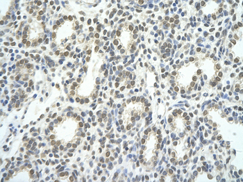 TEAD1 Rabbit Polyclonal Antibody