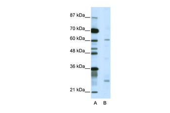 NR1I2 Rabbit Polyclonal Antibody