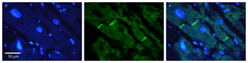 LASS2 Rabbit Polyclonal Antibody