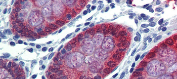 HOXC8 Rabbit Polyclonal Antibody