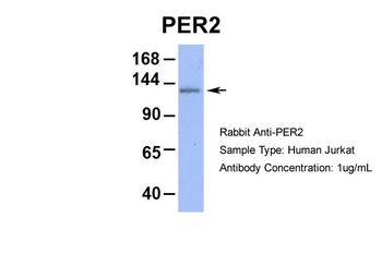 PER2 Rabbit Polyclonal Antibody