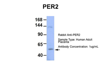 PER2 Rabbit Polyclonal Antibody