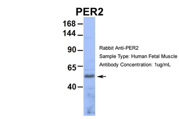 PER2 Rabbit Polyclonal Antibody