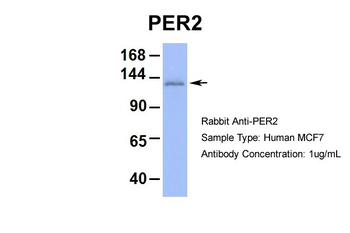 PER2 Rabbit Polyclonal Antibody