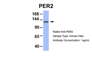 PER2 Rabbit Polyclonal Antibody