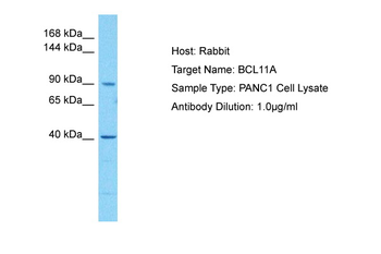 BCL11A Rabbit Polyclonal Antibody