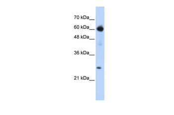 EBF1 Rabbit Polyclonal Antibody