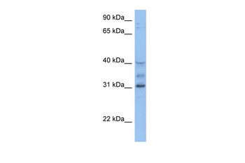 HOXD1 Rabbit Polyclonal Antibody
