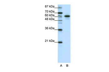 CBLL1 Rabbit Polyclonal Antibody