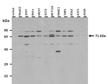 GRHL2 Rabbit Polyclonal Antibody