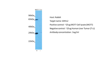 GRHL2 Rabbit Polyclonal Antibody