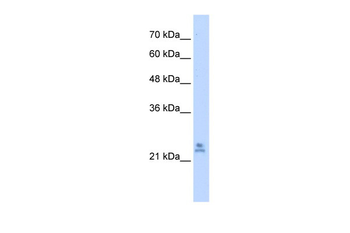MRPS15 Rabbit Polyclonal Antibody