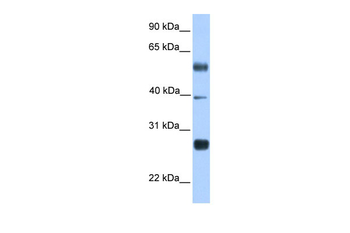 MXD3 Rabbit Polyclonal Antibody