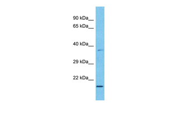 MXD3 Rabbit Polyclonal Antibody