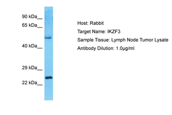 IKZF3 Rabbit Polyclonal Antibody