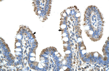 RIOX2 Rabbit Polyclonal Antibody