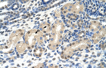 MLXIPL Rabbit Polyclonal Antibody