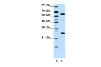 HMGB4 Rabbit Polyclonal Antibody