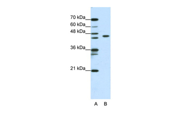ZBTB9 Rabbit Polyclonal Antibody