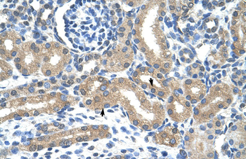 HIF3A Rabbit Polyclonal Antibody