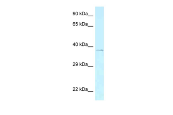 Aebp2 Rabbit Polyclonal Antibody