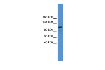 NFATC1 Rabbit Polyclonal Antibody