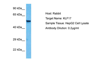 KLF17 Rabbit Polyclonal Antibody