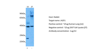 JAZF1 Rabbit Polyclonal Antibody