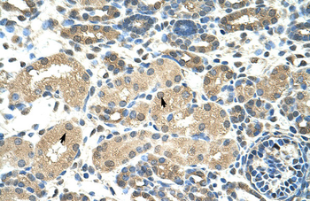 DMRT2 Rabbit Polyclonal Antibody