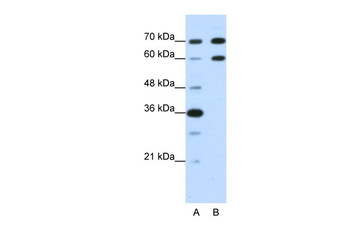 DMRT2 Rabbit Polyclonal Antibody