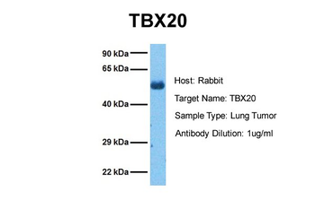 TBX20 Rabbit Polyclonal Antibody