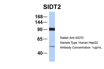 SIDT2 Rabbit Polyclonal Antibody